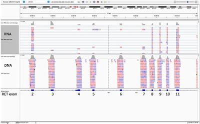 RET splice site variants in medullary thyroid carcinoma